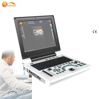 Nový Príchod Lacné Farby Dopplerov Ultrazvuk SLNKO-902A Notebook Ecography Ultrazvuk Stroj
